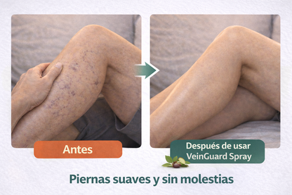 VeinGuard Spray para Várices (Alivio Rápido y Sin Dolor)+ Ebook de Regalo